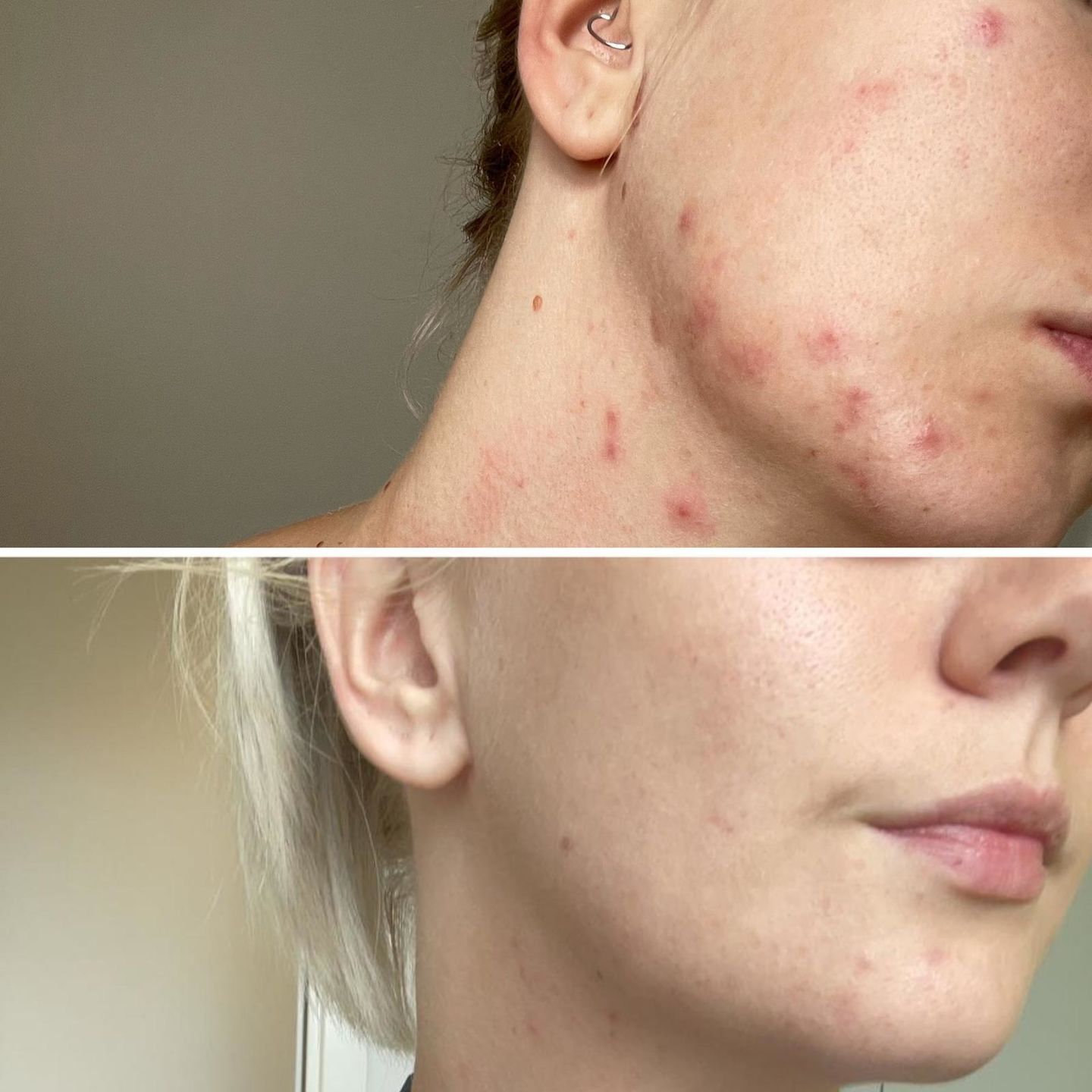 before and after using naked cleansing grains